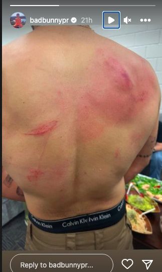 Bad Bunny after Backlash