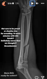 Bryan Danielson X-Ray